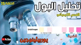 Urinalysis 15 Chemical Ex Urobilinogen Dipstick