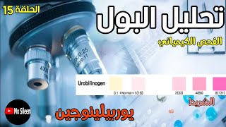 Urinalysis 15 chemical ex (Urobilinogen) dipstick