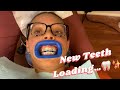 New Teeth Loading!!! My Journey To Straight Teeth! Dandy Aligners Update 1/First 5 Days