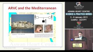 Arrhythmogenic Right Ventricular Cardiomypathy In Egypt