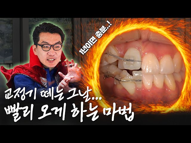 교정기간을 당기려면 치과와 의사도 중요합니다!