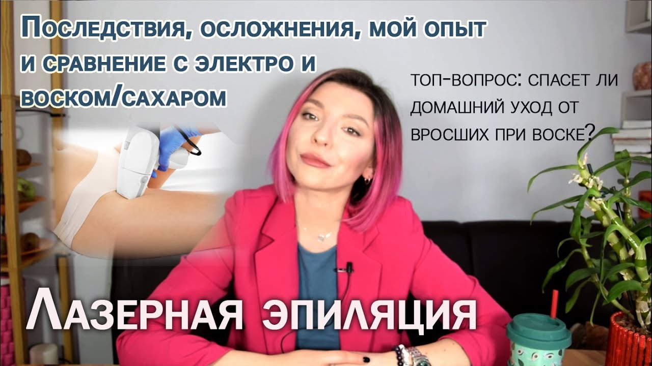 ЛАЗЕРНАЯ ЭПИЛЯЦИЯ: надолго ли эффект, мой опыт в сравнении с электро ...