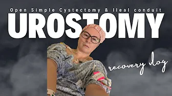 Urostomy / Ileal Conduit & Open Cystectomy Surgery Recovery Vlog