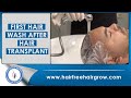 first hair wash after hair transplant || hairfree hairgrow clinic