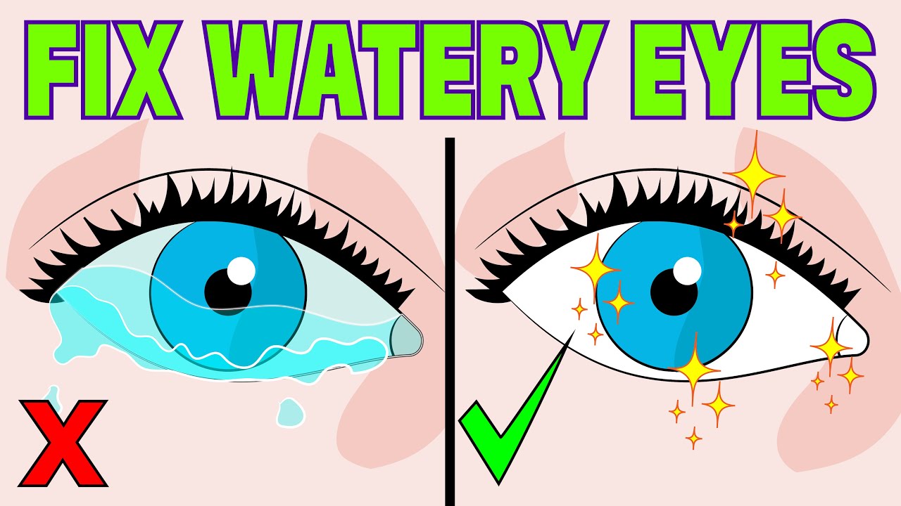 How to Stop Watery Eyes at Home in 3 minutes
