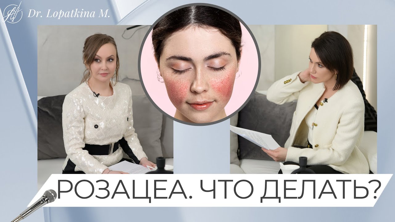 Розацеа. Причины и лечение. - YouTube