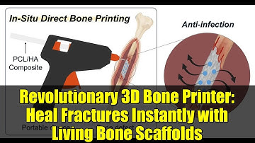 Revolutionary 3D Bone Printer: Heal Fractures Instantly with Living Bone Scaffolds