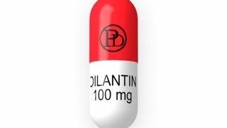 Epilepsy Expert Discusses Dilantin: long term problems