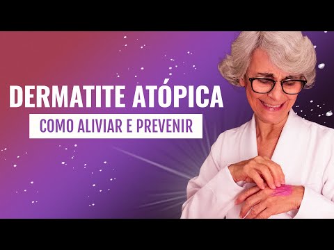 Dermatite Atópica: O que é? Como tratar?