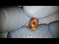 Demonstration on root canal irrigation Dr Mohammad Alqadri mp3