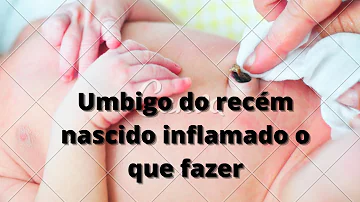 O que fazer quando o umbigo do bebê inflama?