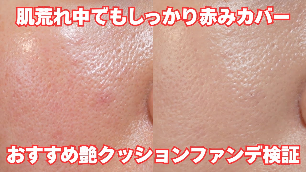 肌荒れの赤みも開き毛穴も1つで即カバー✨おすすめ艶クッションファンデを半日検証！！