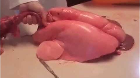 How breathing affects your lung pH - inflated lungs