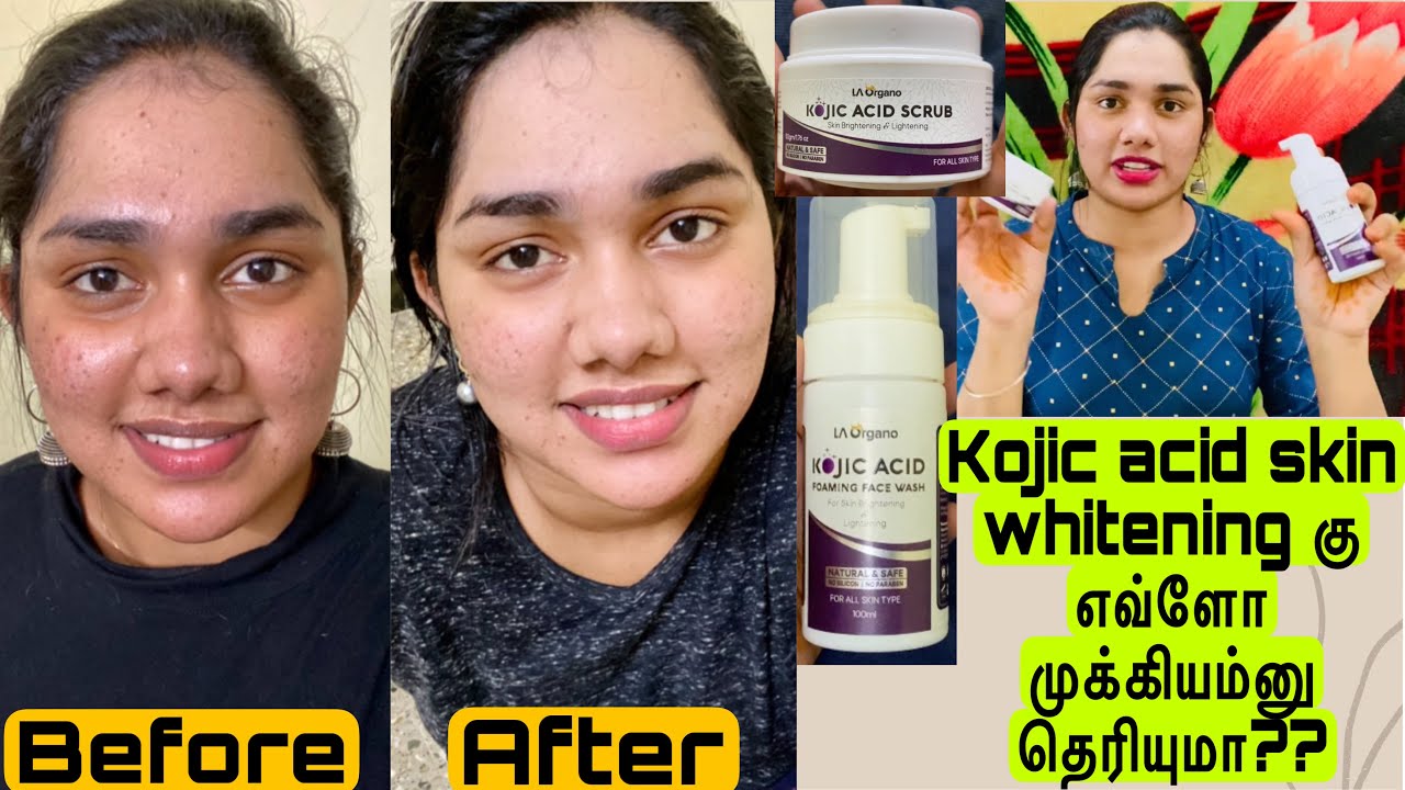 Kojic acid face wash and scrub for extreme skin whitening 