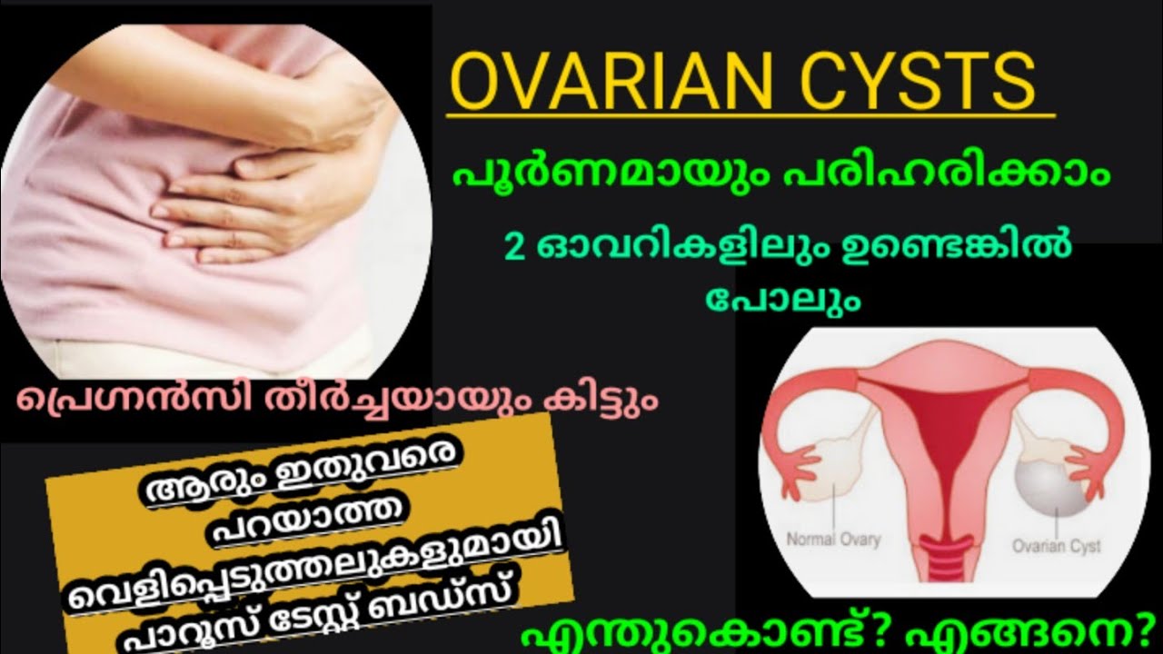 9 fact about ovarian cyst Malayalam pcod pcos ovariancysts 