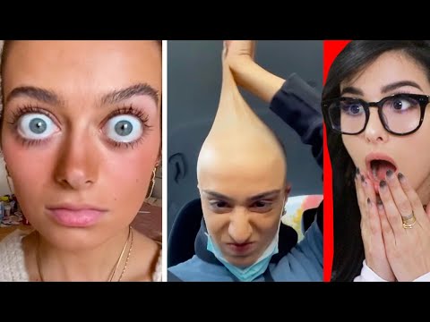 People With Unique Features On Tiktok