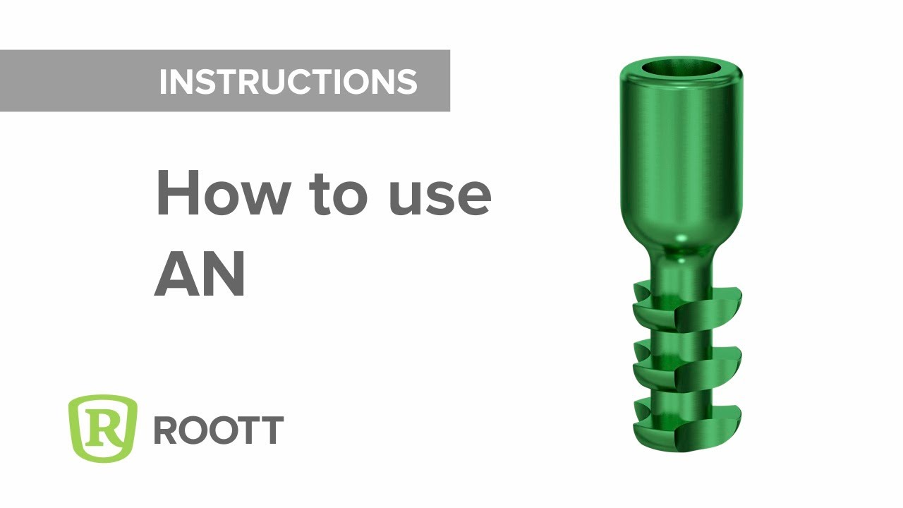 How to use AN Implant Analog YouTube