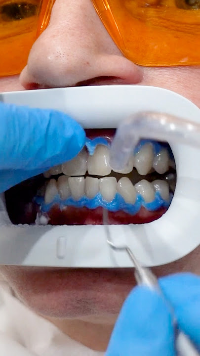 When your smile shine,so do you! #teethwhitening #asmr #dental
