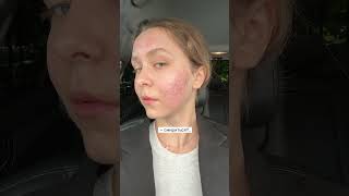 ОТ ПОСТАКНЕ НЕВОЗМОЖНО ИЗБАВИТЬСЯ?!
