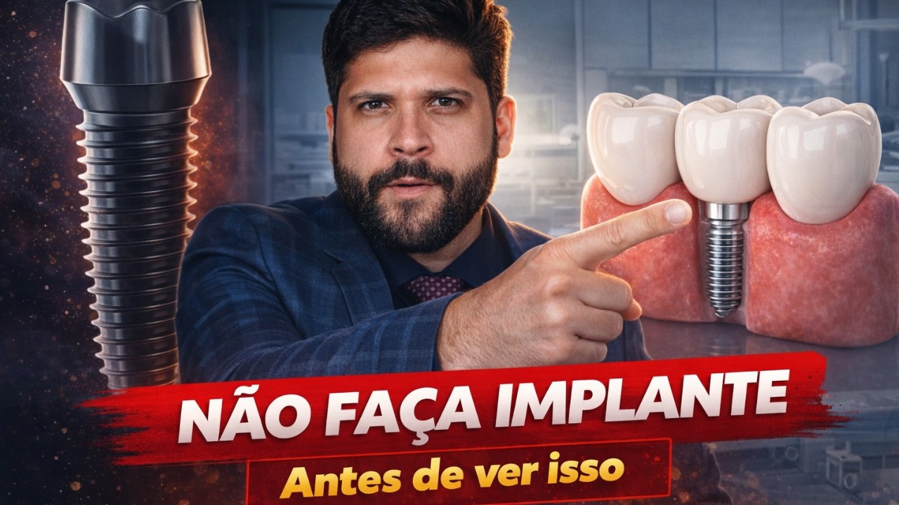 DENTES FIXOS SEM IMPLANTE E SEM CIRURGIA? Conheça a famosa PONTE FIXA!