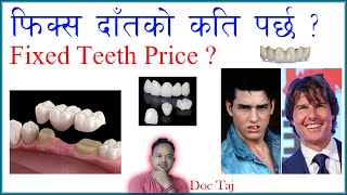 Fixed Partial Denture Pricefpd फकस दतक दम Dental Bridge Doc Taj Dentist In Kathmandu