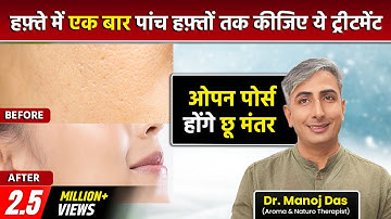 सिर्फ 2 USES में खत्म Clogged Pores, Blackheads, Bumps, Whiteheads and Large Pores I DR. MANOJ DAS