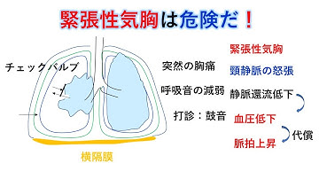 緊張性気胸 Youtube 緊張性気胸 Youtube