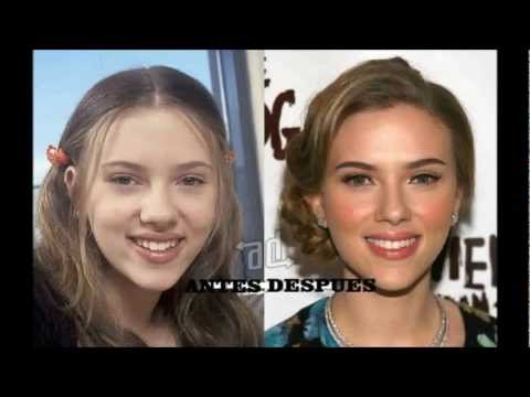 Antes y despues adelgazar famosos brasileiros
