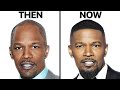 Jamie Foxx Hair Transplants