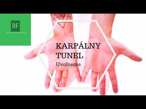 Video: Necitlivosť V Zápästí: Karpálny Tunel, Artritída A Liečba