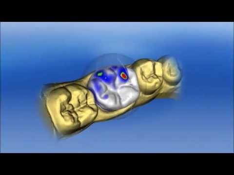 digital marketing Sirona CEREC Software 4.0 (de)