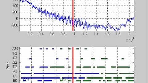 EMDsonic: EEG sonifcation using EMD & HHT signal processing approach.