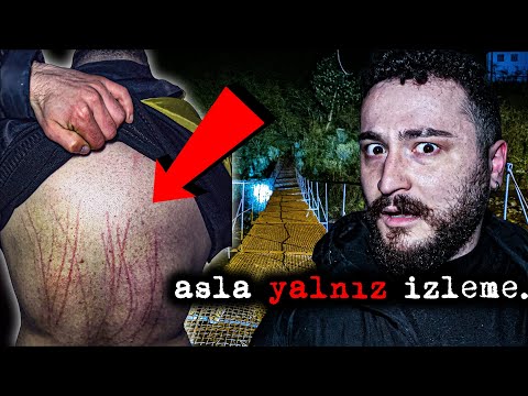 YARALANDIM! - KÖPRÜDE KORKUNÇ VARLIKLA KARŞILAŞTIK!