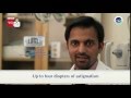 Dranurag mathur talks about astigmatism