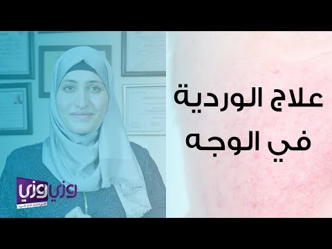 علاج الوردية في الوجه