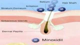 How to Make Minoxidil (Rogaine) More Effective