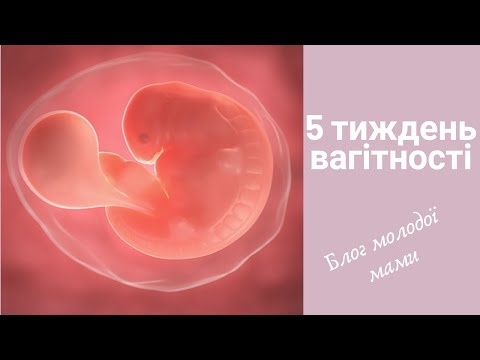 5 тиждень вагітності/ Перші симптоми вагітності