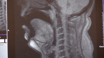 OperaScan - Two Wagner tenors in MRI-scanner - Gruseliges video