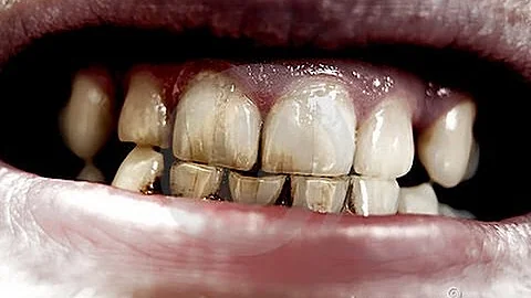 ¿Cómo se cepillaban los dientes los romanos?