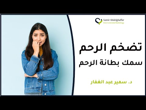 فيديو: هل يمكن أن يختفي فرط التنسج الفصيصي اللانمطي؟