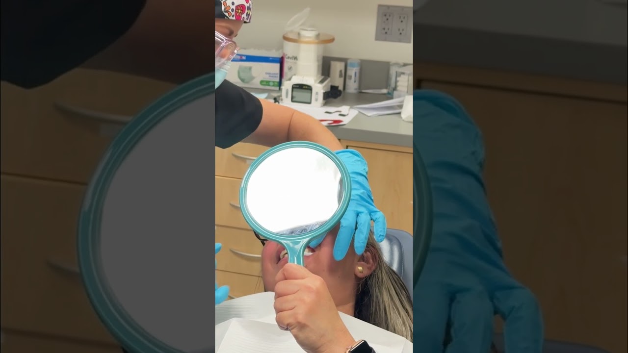 Amazing Cement-Retained Crown: Dental Work Transformation! 