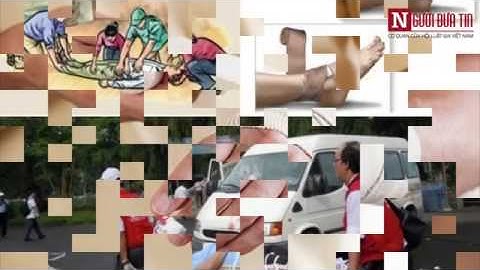 Clip- Cách Điều Trị Khi Bị Rắn Lục Đuôi Đỏ Tấn Công