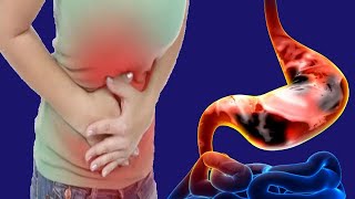 Stomach Cancer: Causes And Treatment