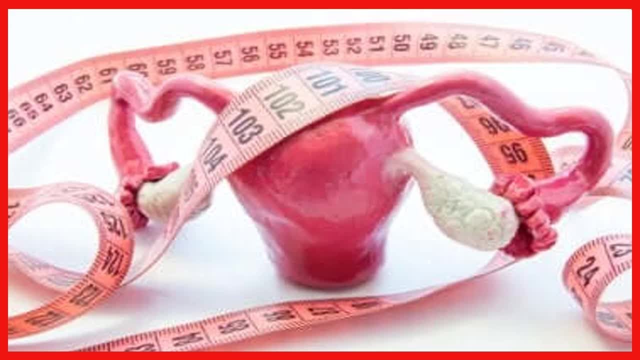 Wissenswertes über Gebärmutterpolypen