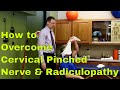 How To Overcome Cervical Pinched Nerve And Radiculopathy. "No Worries"
