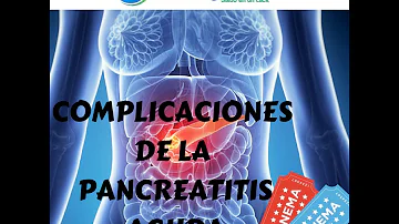 ¿Cuál es la complicación más frecuente de la pancreatitis aguda?