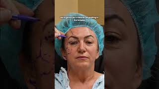 Today's Facelift Patient