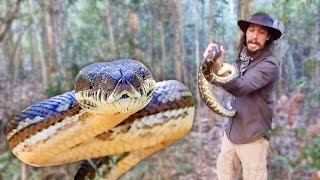 Celebrity The Worst Snake Bite Doctor's Have Ever Seen | 9 Lives | Wealth