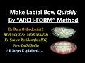 Correct labial bow position  wire selection make quickly by arch form method all steps explained