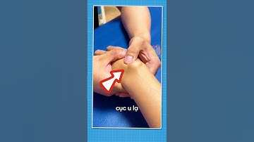 Đừng Bao Giờ Đập Cục U Này! 😱